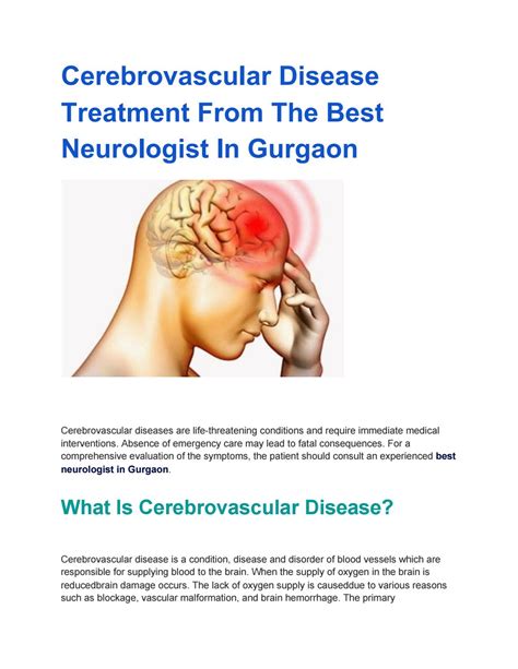 Cerebrovascular Disease Treatment From The Best Neurologist In Gurgaon