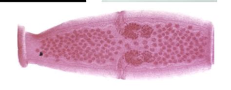 P Other Helminths Flashcards Quizlet