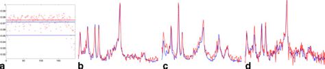 Scalar Product R RSI EPE Comparison In One GBM Patient For All