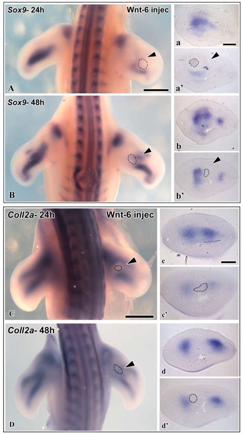 In Situ Hybridization Of Chicken Wing Buds With Probes Against