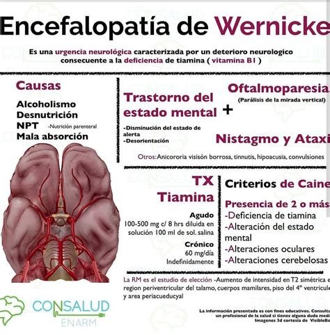 Hablemos de encefalopatía de Wernicke consaludenarm online