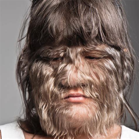 Supattra Natty Sasufan What The World S Most Hairy Woman Looks Like Today From The Guinness