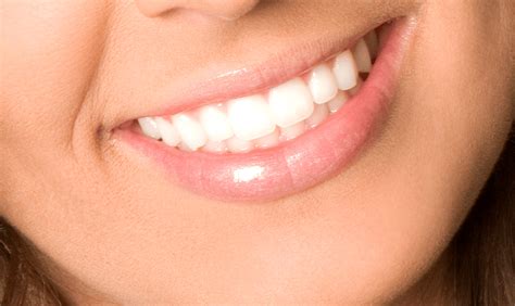 Whiten Your Teeth Safely And Effectively Understanding Teeth Whitening