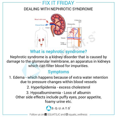 Nephrotic Syndrome Signs And Symptoms