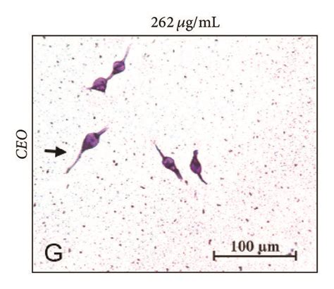 Morphological Changes In Hela Cells Treated With R Officinalis Reo