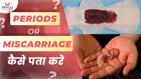 Periods Miscarriage Miscarriage Blood Color