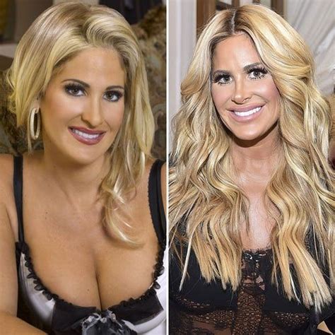 Kim Zolciak Before And After