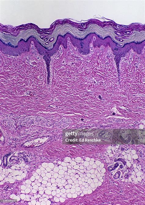 Skin Epidermis Dermis Subcutaneous Layer Thick Skin 25x At 35mm Shows