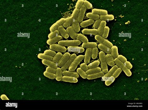 Escherichia Coli O157 Hi Res Stock Photography And Images Alamy