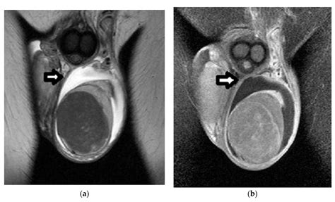 Cancers Free Full Text An Overview Of The Role Of Multiparametric Mri In The Investigation