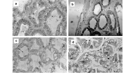 Histological Observations Of Hepatopancreas From White Shrimp Exposed Download Scientific