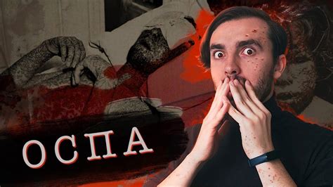 Чёрная Оспа - [История Медицины] - YouTube