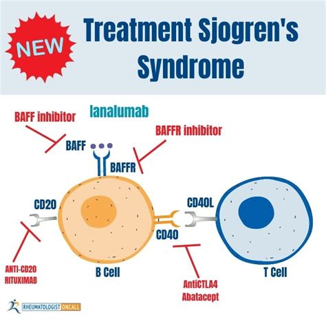 IANALUMAB - New Treatments For Sjogren’s Syndrome