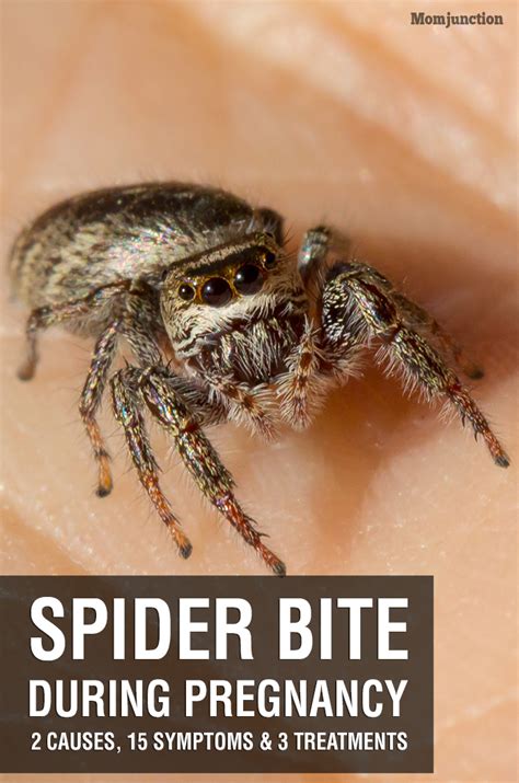 Spider Bite During Pregnancy – Causes, Symptoms & Treatments