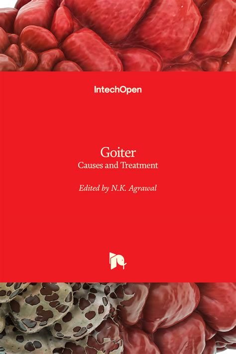 Goiter - Causes and Treatment | IntechOpen