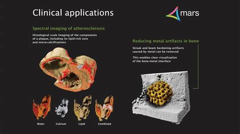 This Unique X-ray Scanner Creates 3D Images Of Human Body