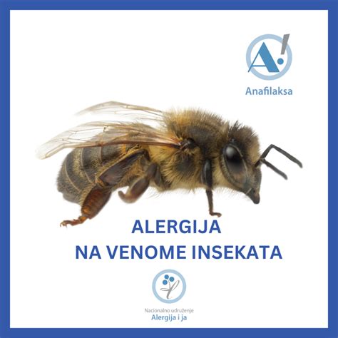 Alergija Na Venome Insekata Alergija I Ja