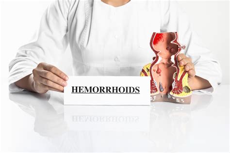 External Hemorrhoids Treatment