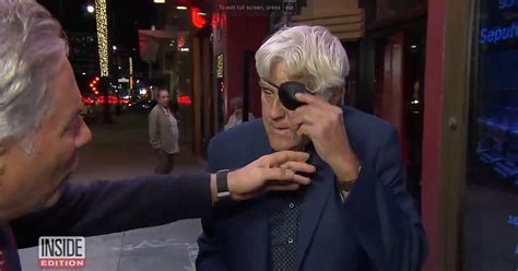 Jay Leno Sparks Theories He Didnt Fall Down A Hill