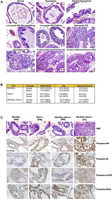 Phenotypes of Male PB PKCε and PB PKCε Pten À Mice A H E staining