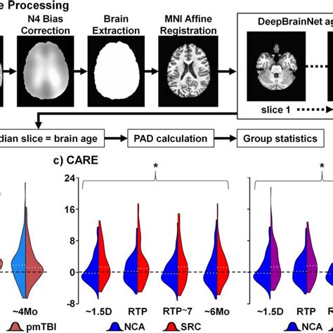 Panel A Depicts The Brain Age Estimation Method Raw T1 Weighted Data