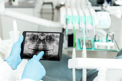 What Is Dental Technology Moorehead Dentistry