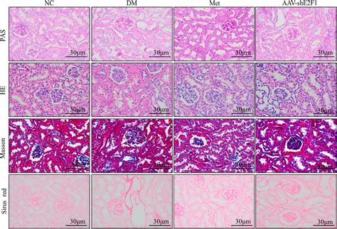 Frontiers Metformin Improves The Senescence Of Renal Tubular