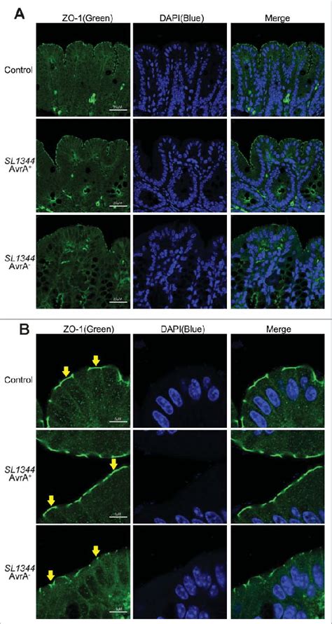 Immunostaining Of Zo In Vivo Immunostaining On Colonic Epithelial