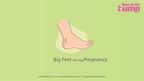 Big Feet During Pregnancy