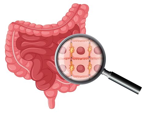 Mikrobiota A Choroby Zapalne Jelit NANOBIOME