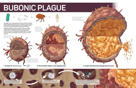 Bubonic Plague In California 2024 Wikipedia Flora Jewelle