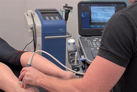 Ultrasound Guided Shockwave