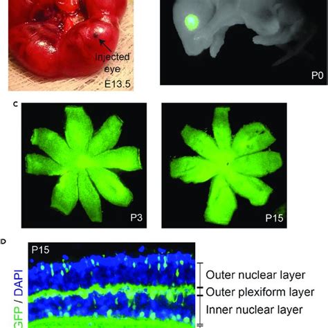 Efficient Viral Transduction In The Early Postnatal Retina Following In