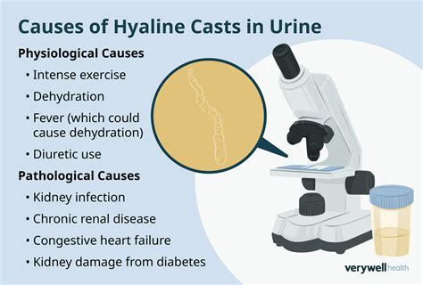 Hyaline Casts In Urine