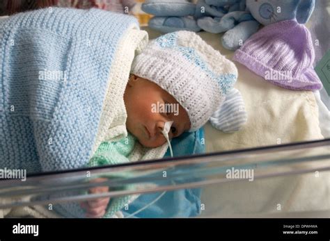 Premature newborn baby boy in hospital cot with a feeding tube attached ...