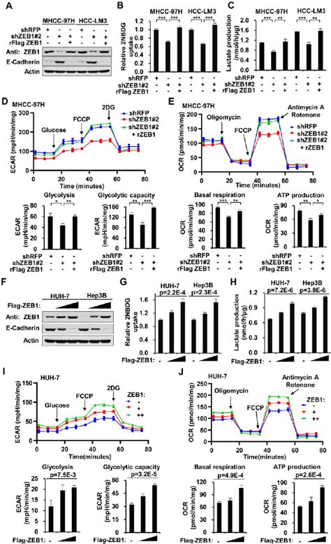 High Expression Of Zeb1 Enhances Glycolysis A Western Blot Analysis