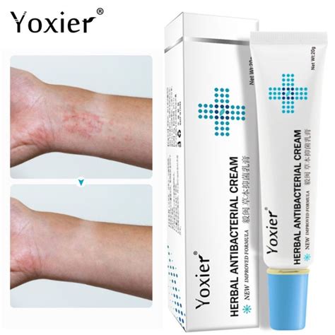 Yoxier Herbal Antibacterial Cream Eczema Cream Psoriasis Cream Anti