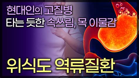 현대인의 고질병 위식도 역류질환 소화 불량 타는 듯한 속쓰림 목 이물감이 있다면 역류성식도염 140927