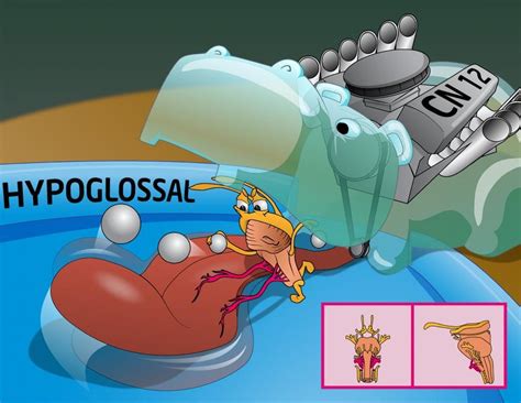 Anatomy Of The Spinal Accessory Cn Xi And Hypoglossal Cn Xii Nerves