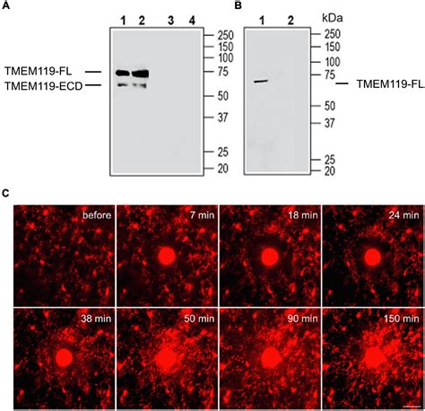 Frontiers A New Understanding Of Tmem As A Marker Of Microglia