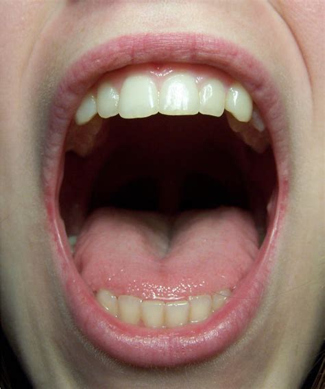 Mouth Detail Front by Della-Stock on DeviantArt