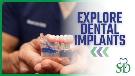 Dental Implants Are A Game Changer Explore Dental Implants YouTube