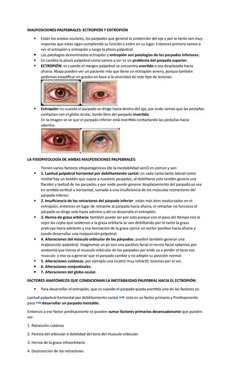 malposiciones palpebrales  ptosis palpebral oftalmologia