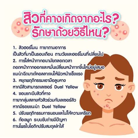 สิวที่คาง เกิดจากอะไร เกิดซ้ำบ่อยจนกวนใจ พร้อมวิธีป้องกันและรักษาสิว