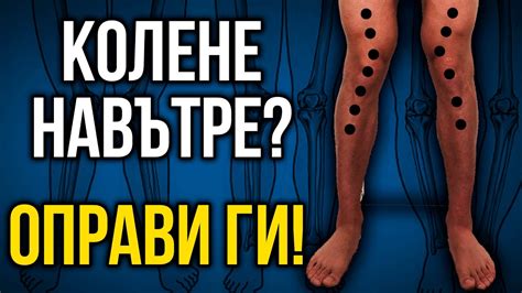 Как да изправим КОЛЕНЕ НАВЪТРЕ (valgus knees) - 3 упражнения ...