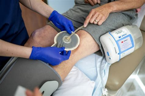 3m Vac Therapy Negative Pressure Wound Therapy Achieves Key Medical