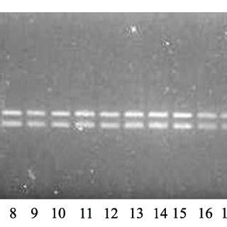 Ethidium Bromide Stained Agarose Gel Electrophoresis Of Amplified