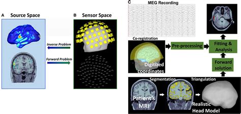 Frontiers Current And Emerging Potential Of Magnetoencephalography In