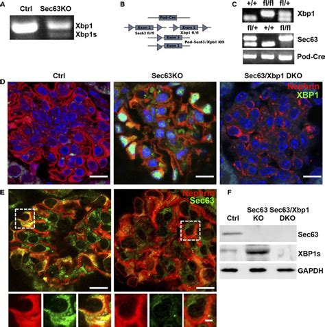 Loss Of Sec63 In Podocytes Induces Xbp1 Splicing A RT PCR Of Xbp1