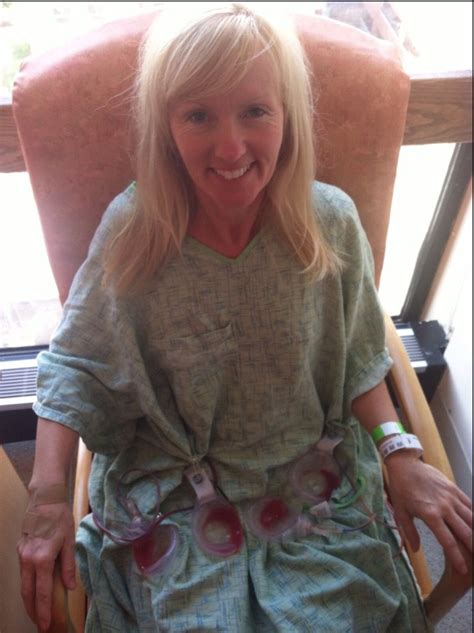 Less Than 24 Hours After Double Mastectomy 4 Jackson Pratt Drains 2 Tissue Expanders And A